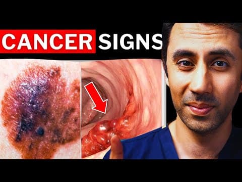 11 Hidden Cancer Signs Everyone Should Know (Doctor Explains)