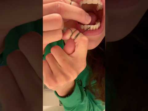 dental hygienistās teeth after hot chocolate #shorts
