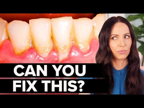 Gingivitis Is Reversible!