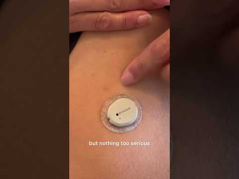 My CGM doesnāt fall off, it sticks for the full 10+ days #cgm #dexcom