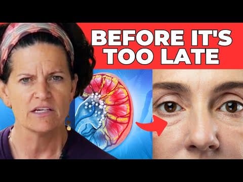 How Your Body Is Warning You About Kidney Problems! | Dr. Mindy Pelz