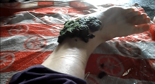 The #1 Reason Many Older Adults Have Swollen Feet (Hint: Not Salt, Sugar, or Aging)